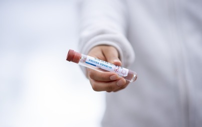 Zdjęcie do ZMIANA GODZIN DZIAŁANIA PUNKTU POBRAŃ MATERIAŁU BIOLOGICZNEGO DO PRZEPROWADZENIA TESTU NA OBECNOŚĆ WIRUSA SARS-CoV-2